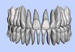 maxillary mandibular teeth set pulp tooth mouth jaw bone dentistry skull anatomy anatomical science biology 3d print model - Mito3D