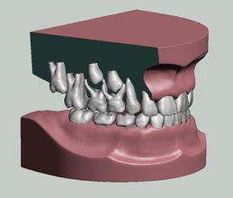 karıştırmak dişlenme model bireysel diş anatomi hekimliği ağız çocuk modeli bilim biyoloji 3d print model - Mito3D