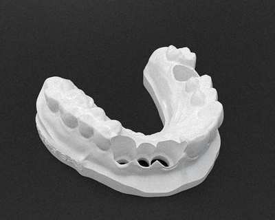 modelo practicas carillas dental dientes odontología diente dentista mella Ciencias 3d print model - Mito3D