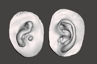 natural ear anatomy microtia art prosthesis anaplastology science other sculptures 3d print model - Mito3D