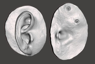 naturale umano orecchio anatomia attaccamento trattenuto protesi microtelefono epiteti anaplastologia maxillofacciale osso ancorato scienza biologia 3d print model - Mito3D