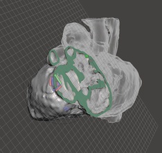 newborn human child heart anatomy realsize valve septum science biology 3d print model - Mito3D