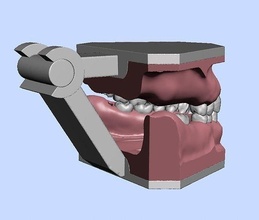 d011 oral chirurgie période modèle dentaire parodontie dentiste technologie dent dents anatomie impactée science biologie 3d print model - Mito3D