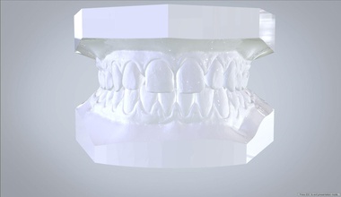 orthodontic planning study model dental 3d 3shape lab medical teeth orthodontics tooth keyshot labmagic3dcad 3dprint science dentistry cad digital printable medicine 3d print model - Mito3D