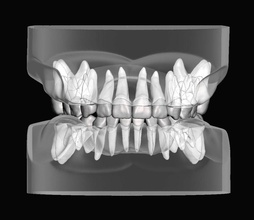 pédiatrique dentaire modèle individuel dents dent dentisterie bouche mâchoire émail dentine dentiste molaire dentition science biologie 3d print model - Mito3D