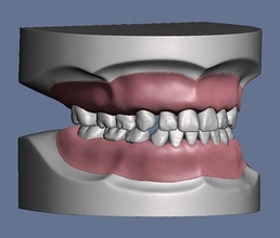 pediátrico dental modelo tipodonto tipo dientes separar goma diente boca odontología mandíbula oral esmalte dentista mella molar ciencias biología 3d print model - Mito3D