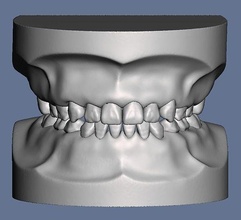 pediatric dental model typodont type teeth tooth jaw anatomy mouth skull dentistry dentin enamel anatomical molar cuspid dentition science biology 3d print model - Mito3D