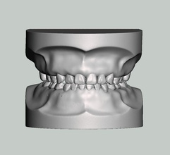 pediatrico dentale modello dentista bambino denti medicinale bocca spazzolino ragazzo dente smalto scienza biologia 3d print model - Mito3D