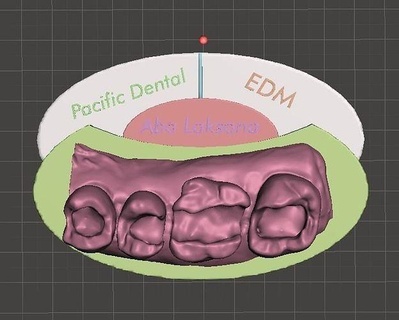 classe 1 mod xícaras redução ii edm dental edmdentalpractice dentista Ciência odontologia dentes boca canino dente laboratório dentário escola arte incisivo anterior 3d print model - Mito3D