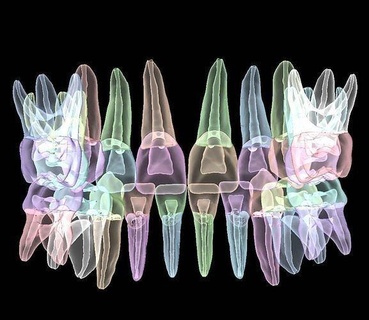 birincil diş anatomi model kök kanal ayrı Yazdır çocuk pediatrik doktoru hekimliği teknolojisi Bilim Biyoloji 3d print model - Mito3D