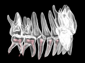 primario denti anatomia modello smalto dente bocca dentale mascella dentista odontoiatria cura scienza biologia 3d print model - Mito3D