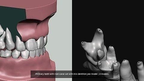 primario denti radice canale impostato mescolare dentizione mascella modello anatomia dente dentale odontoiatria bocca bambino dentalmodel primari scienza biologia 3d print model - Mito3D