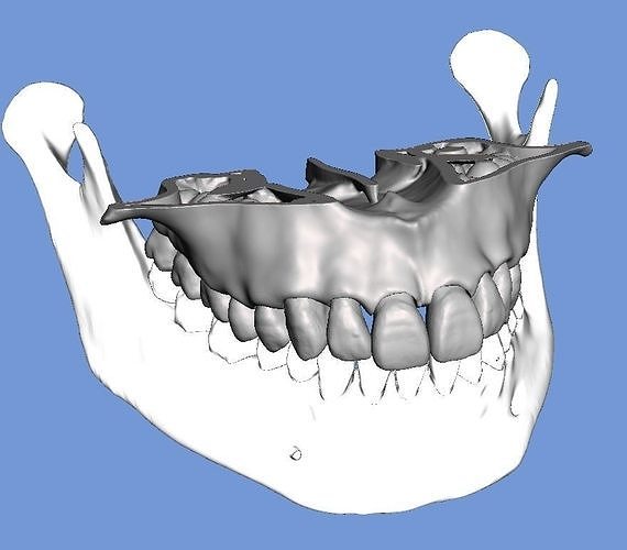 d006 real human maxillary jaw anatomy teeth 3d print model dental mouth tooth enamel dentist dentistry dentin molar skull dentition science biology 3D print model - Mito3D