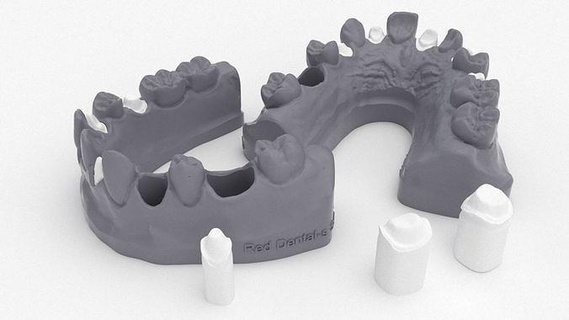 sanduíche modelo wax up prática dente dental cera pu Ciência 3d print model - Mito3D