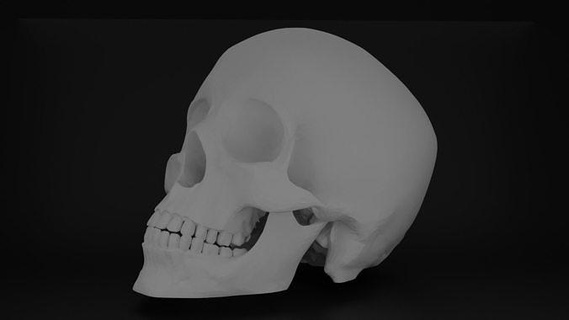 scanned human skull anatomy dental cavity composite class 2 arch upper lower teeth tooth quadrant science biology dentist dentistry incisor orthodontist 3d print model - Mito3D