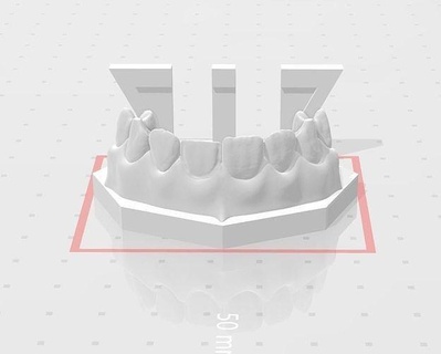 segmentario directo chapa edm dental práctica edmdentalpractice dentista Ciencias odontología dientes boca diente canino incisivo laboratorio escuela odontologia fotografía 3d print model - Mito3D