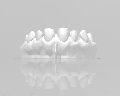 segmenté précédent vernis préparation edm dentaire entraine cabinet dentaire dentiste science dentaire dentisterie dents bouche dent précédent canin incisif laboratoire dentaire art dentaire école dentaire photographie dentaire 3d print model - Mito3D