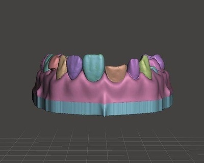 segmenté mixte cambre complexe cas edm dentaire entraine cabinet dentiste science dentisterie dents molaire bouche dent canin laboratoire précédent art incisif 3d print model - Mito3D