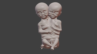 siamese zwilling fötus baby seltsam behindert außergewöhnlich unheimlich halloween babys grusel krug kunst wissenschaft körper gruselig verbunden 3d drucken skulpturen 3d print model - Mito3D
