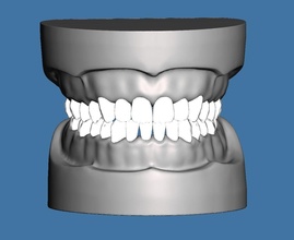 solide base données dentaire anatomique typodonte dentiste anatomie dents dent bouche brosse dentisterie science biologie 3d print model - Mito3D