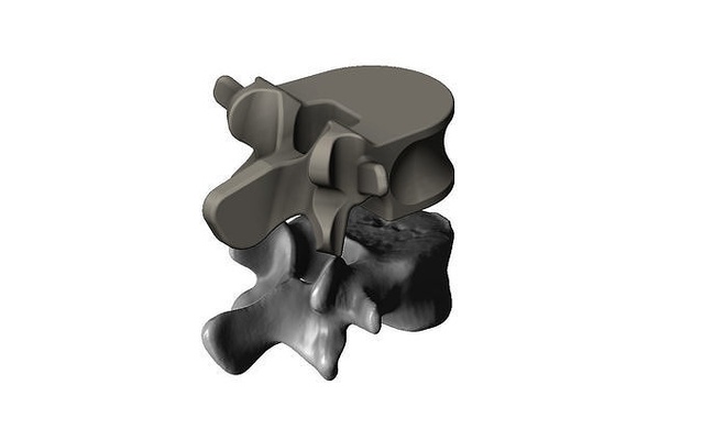 espinal vértebras protésico médico anatomía huesos fea ciencias biología medicamento columna vertebral esquelético esqueleto humano biomédico ingenieria mecánico cnc 3dprinting biomecánica 3d print model - Mito3D