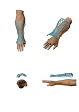 technology medical on broken arm body 3d science 3d print model - Mito3D