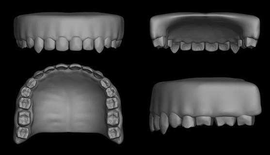 teeth - upper jaw dental anatomy science tooth skull tool human print dentist dentistry medical mouth molar art sculptures 3d print model - Mito3D