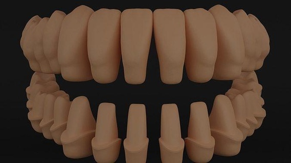 dientes restauracion 3d impresión modelo dentadura cepillo dientes diente dentista medicamento odontología cuidado dental mella raíz conjunto dientes cuerpo anatomía Ciencias médico personaje biología 3d print model - Mito3D