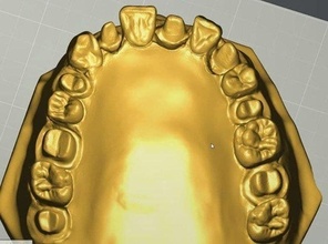 trineo modelo oro diente dental odontología mella dientes dentista ciencias 3d print model - Mito3D