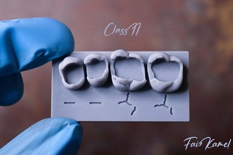 diş üst kemer sınıf 2 modeller anatomi boşluk bileşik çeyrek daire bilim biyoloji doktoru hekimliği kesici ortodontist 3d print model - Mito3D