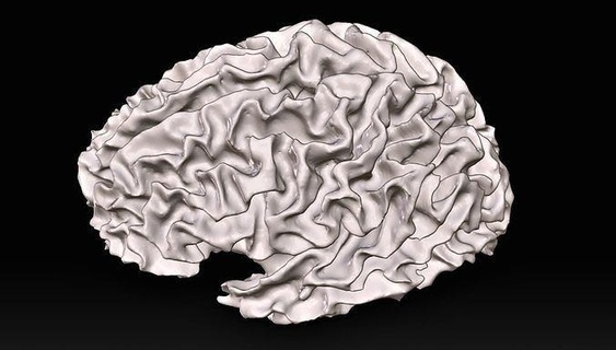 Weiß Angelegenheit Gehirn Hemisphäre Neurologie Illustration Anatomie Medizin medizinisch Biologia Biologie Wissenschaft 3d print model - Mito3D