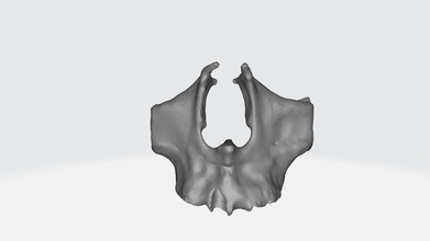 zygomatic bone maxillary jaw mandible dental implants medical 3dmodeling modeling 3d science biology 3d print model - Mito3D