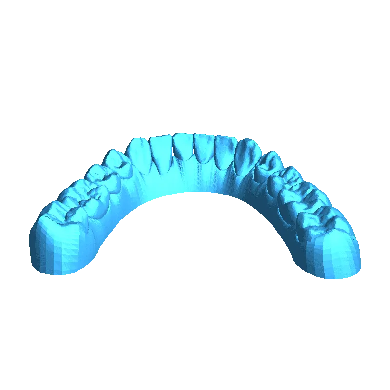 dente 3d modelos baixar crialidade nuvem 3D print model - Mito3D