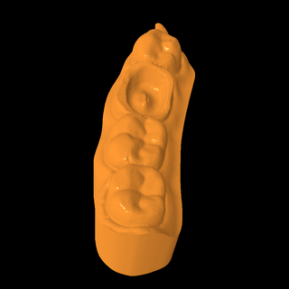 modelo odontologia inlay Others 3d print model - Mito3D
