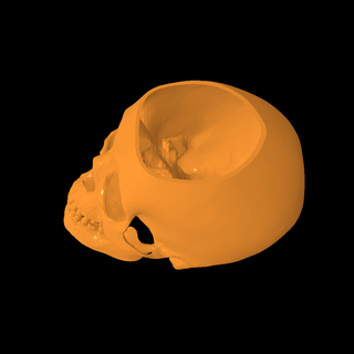 cráneo 3d print model - Mito3D