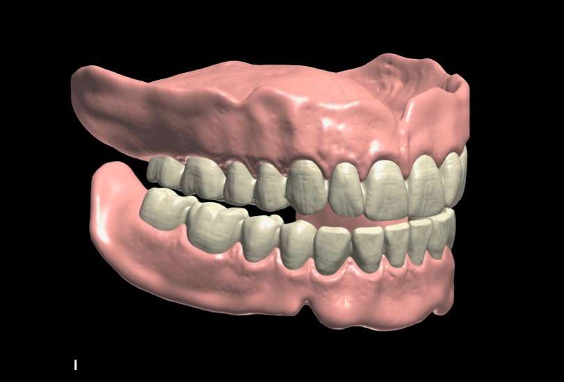 teeth Others 3D print model - Mito3D