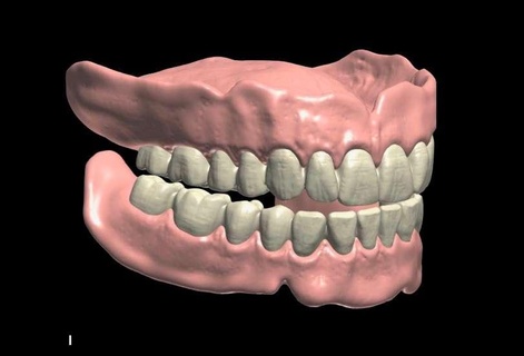 teeth Others 3d print model - Mito3D
