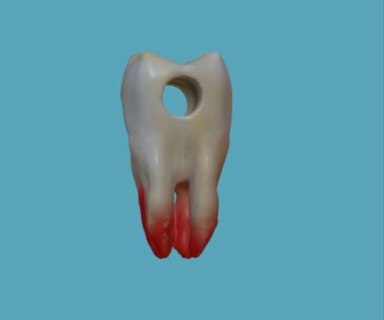 dientes 3d print model - Mito3D