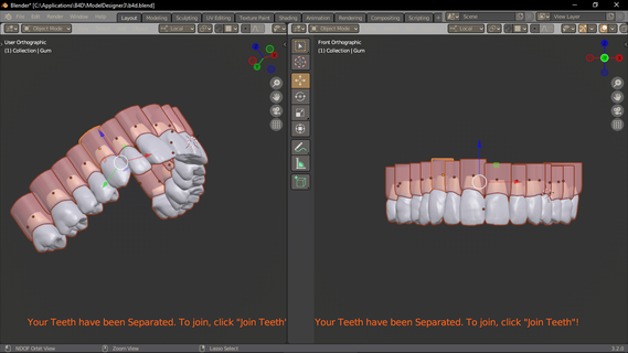 3 superiore arco denti presa gomma biblioteca stl collezione odontoiatria dente 3d print model - Mito3D