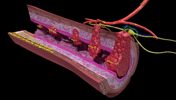 3d Doppelpunkt Krebs Inszenierung Detail beschriftet Bühne Karzinom Metastasierung Tumor Anatomie brutto Mikroskopie medizinisch Wissenschaft Invasion Darm Schleimhaut Submukosa 3d print model - Mito3D