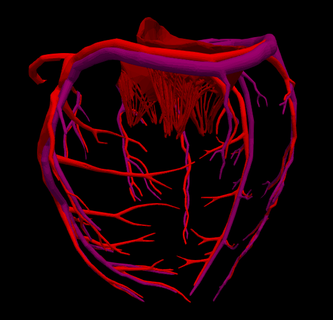 3d Herz Anatomie Kodominanz verschiedene kardiovaskulär System Kammern Modell apikal Aussicht Kardiologie 3d print model - Mito3D