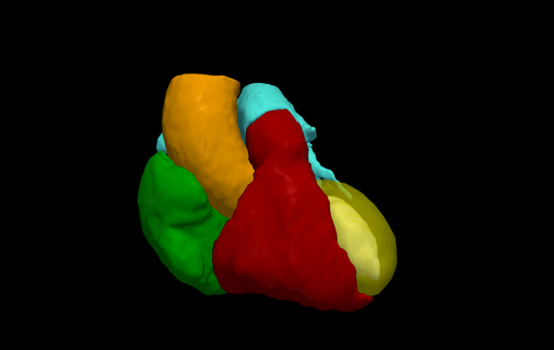 3d Herz Modell generiert Real geduldig verschiedene kardiovaskulär System Kammern apikal Aussicht Kardiologie 3d print model - Mito3D