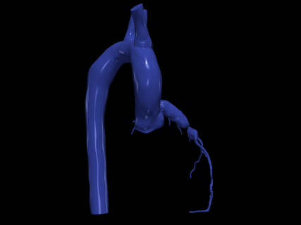 3d model aort koroner arterler kalp kardiyovasküler sistemi Odalar apikal görünüm kardiyoloji kemer arter 3d print model - Mito3D