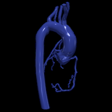 3d modelo aorta coronário artérias 3d print model - Mito3D