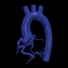 3d model aorta coronary arteries 3d print model - Mito3D