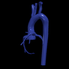3d modello aorta coronarica arterie 3d print model - Mito3D