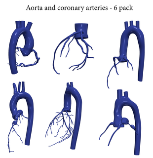 3d model aorta coronary arteries - 6pack heart cardiovascular cardiac system chambers apical view cardiology aortic arch artery 3d print model - Mito3D