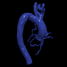 3d modèle aorte coronaire artères 3d print model - Mito3D