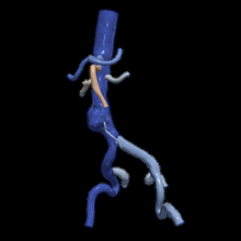 3d modèle aorte fémoral artères 3d print model - Mito3D