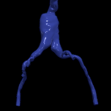 3d modello aorta femorale arterie 3d print model - Mito3D